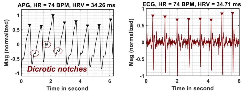 APG signal used in the measurement phase 