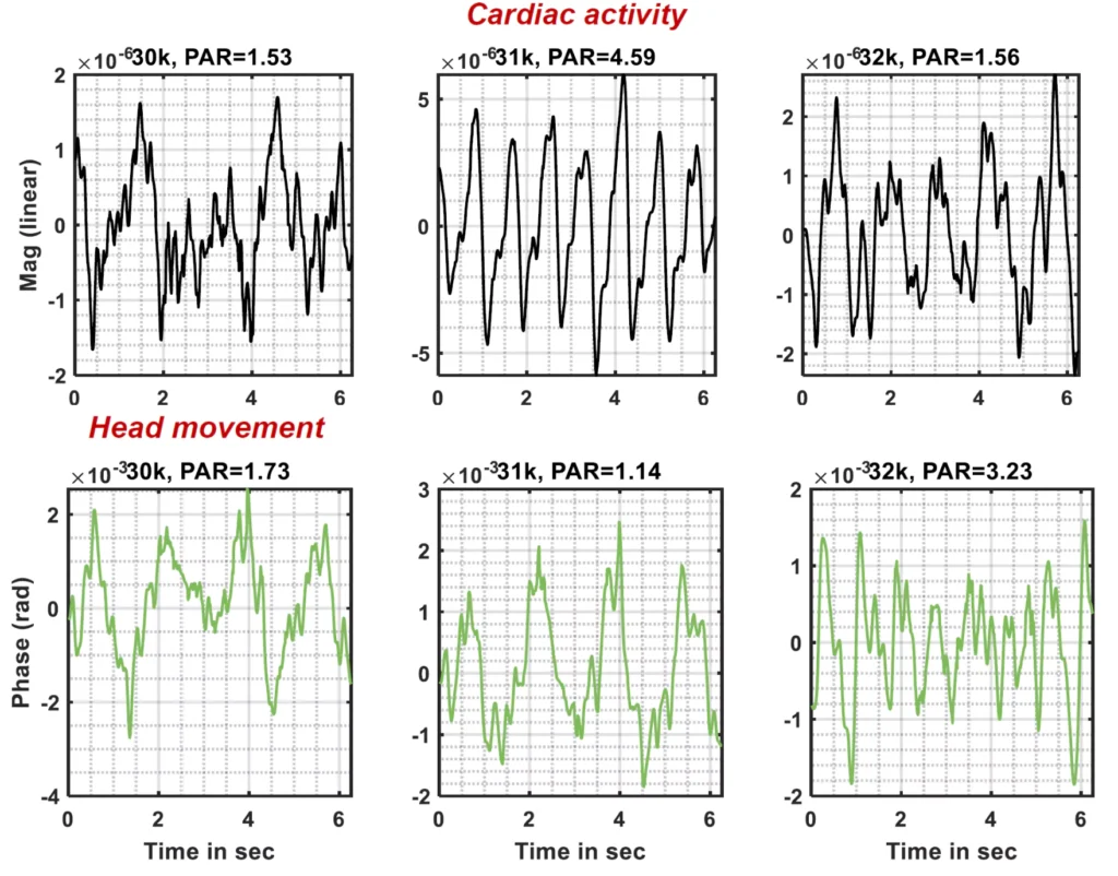 the cardiac activities are captured in some frequencies